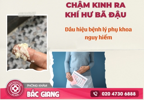 Châm kinh ra khí hư bã đậu là dấu hiệu của nhiều bệnh lý nguy hiểm. chậm kinh ra khí hư bã đậu