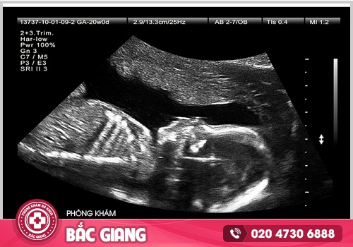 Chi phí siêu âm thai bao nhiêu tiền? Có quá đắt?