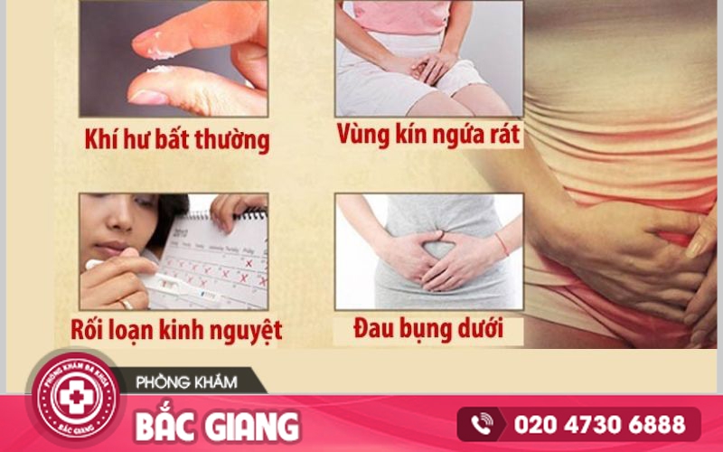 Những dấu hiệu nhận biết viêm âm đạo thường gặp. đi tiểu ra huyết trắng