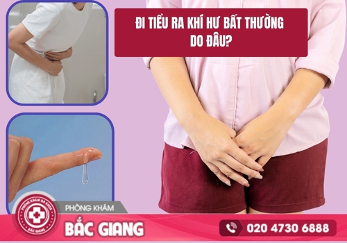 Đi tiểu ra khí hư bất thường là dấu hiệu của nhiều bệnh lý phụ khoa nguy hiểm. đi tiểu ra khí hư bất thường