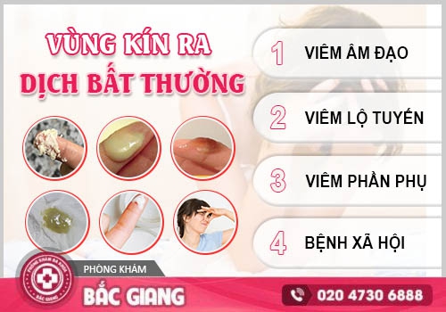 Khí hư bất thường là dấu hiệu bệnh gì? Cảnh báo những nguy cơ tiềm ẩn