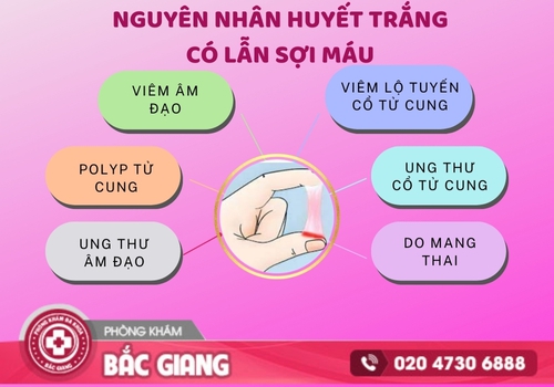 Huyết trắng có lẫn sợi máu xảy ra do nhiều nguyên nhân bệnh lý khác nhau. huyết trắng có lẫn sợi máu