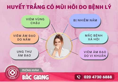 Huyết trắng có mùi hôi do những nguyên nhân bệnh lý. huyết trắng có mùi hôi