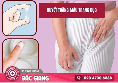 Huyết trắng màu trắng đục xảy ra do nhiều nguyên nhân bệnh lý khác nhau. huyết trắng màu trắng đục