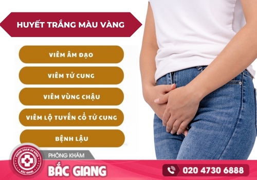 Nguyên nhân gây nên tình trạng huyết trắng màu vàng. huyết trắng màu vàng
