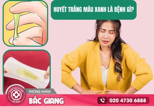 Huyết trắng màu xanh là dấu hiệu của nhiều bệnh lý phụ khoa. huyết trắng màu xanh
