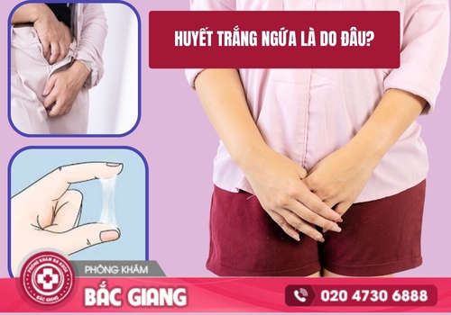 Huyết trắng ngứa xảy ra do nhiều nguyên nhân bệnh lý khác nhau. huyết trắng ngứa