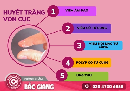 Những nguyên nhân bệnh lý gây nên tình trạng huyết trắng vón cục. huyết trắng vón cục