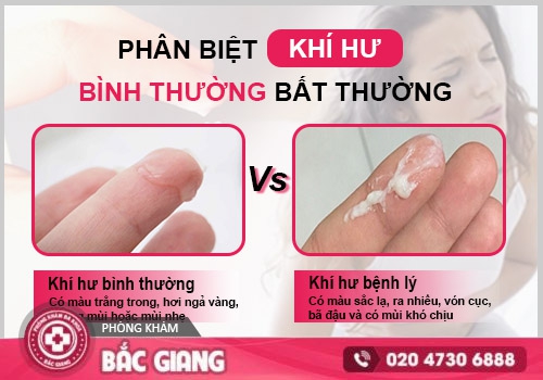 Khí hư ra nhiều bất thường