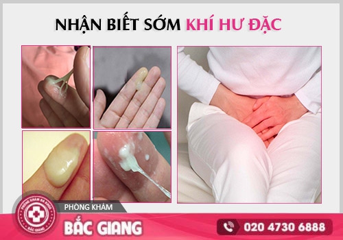 Chị em cần hết sức thận trọng khi gặp tình trạng khí hư đặc. khí hư đặc