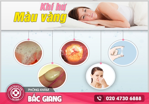 Những nguyên nhân gây ngứa vùng kín và ra dịch màu vàng. ngứa vùng kín và ra dịch màu vàng
