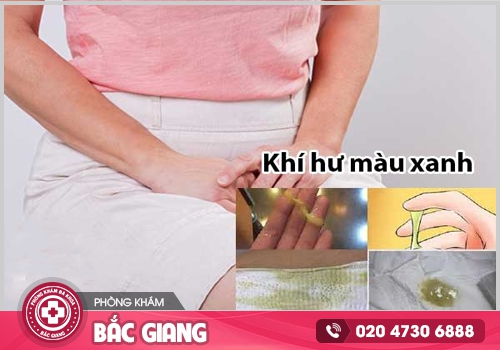 Ngứa vùng kín ra khí hư màu xanh là dấu hiệu của nhiều bệnh phụ khoa nguy hiểm. ngứa vùng kín ra khí hư màu xanh