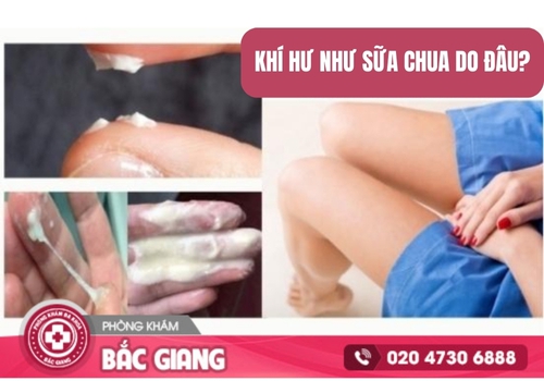 Khí hư như sữa chua là dấu hiệu của các bệnh lý phụ khoa. khí hư như sữa chua