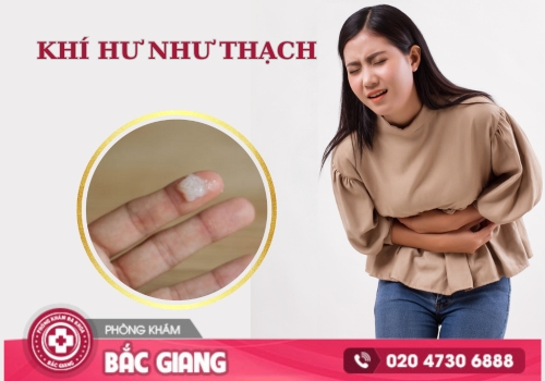 Khí hư như thạch là dấu hiệu của nhiều bệnh lý phụ khoa. khí hư như thạch