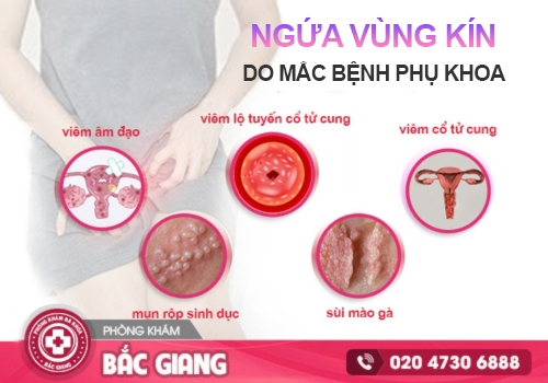 Ngứa vùng kín và ra khí hư là dấu hiệu của nhiều bệnh lý nguy hiểm. ra khí hư có mùi hôi và ngứa