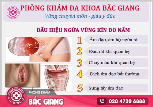 Dấu hiệu ngứa vùng kín do nấm. ngứa vùng kín ra huyết trắng