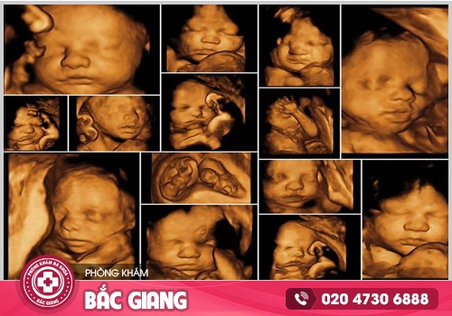 Chi phí siêu âm thai bao nhiêu tiền? Có quá đắt?