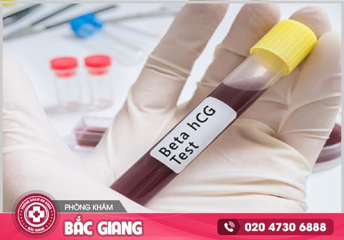 Quan hệ bao lâu thử que được? Thời gian thử que cho kết quả chính xác