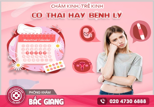 Trễ kinh ra huyết trắng xảy ra do nhiều nguyên nhân khác nhau. trễ kinh ra huyết trắng
